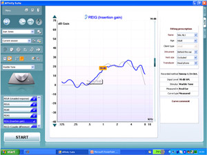 REM440Display REM440Display
