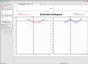 ASSR_Audiogram